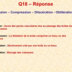 Reponse_Q18